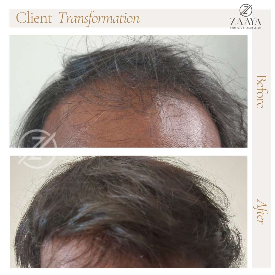 Before and After Instagram Post_20250619_215619_0000