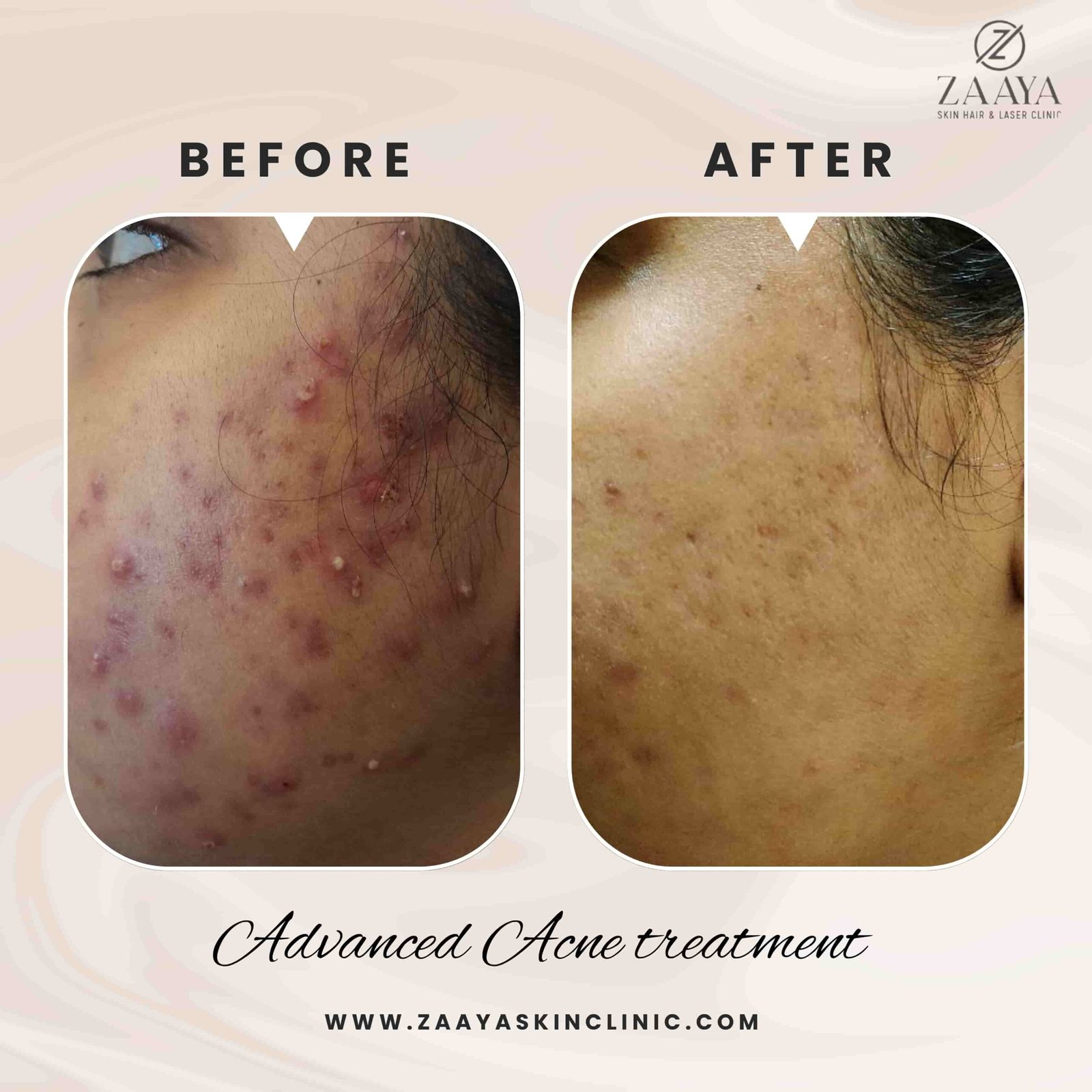 Beige Black Photo Beauty Hair Instagram Post_20250611_210618_0000-min