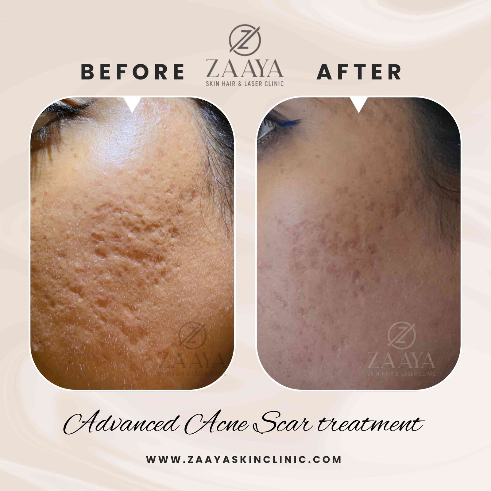 Beige Black Photo Beauty Hair Instagram Post_20250823_230032_0000