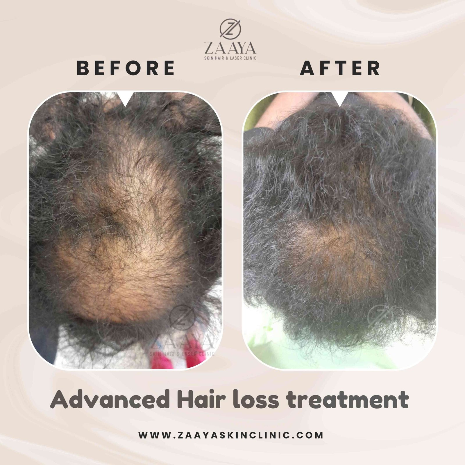 Beige Black Photo Beauty Hair Instagram Post_20250823_230959_0000