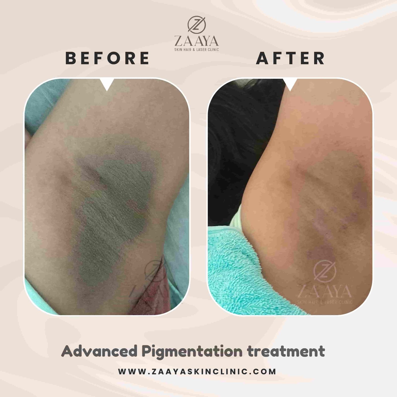 Beige Black Photo Beauty Hair Instagram Post_20250823_231354_0000-min