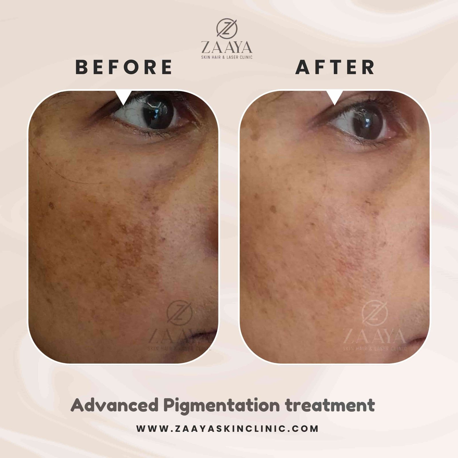 Beige Black Photo Beauty Hair Instagram Post_20250823_231750_0000-min