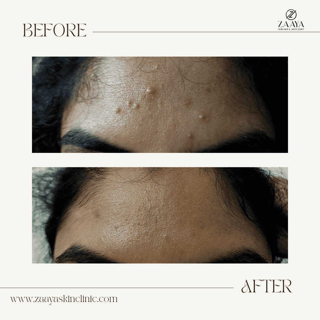 Beige Brown Neutral Before + After Instagram Post_20250616_191131_0000-min