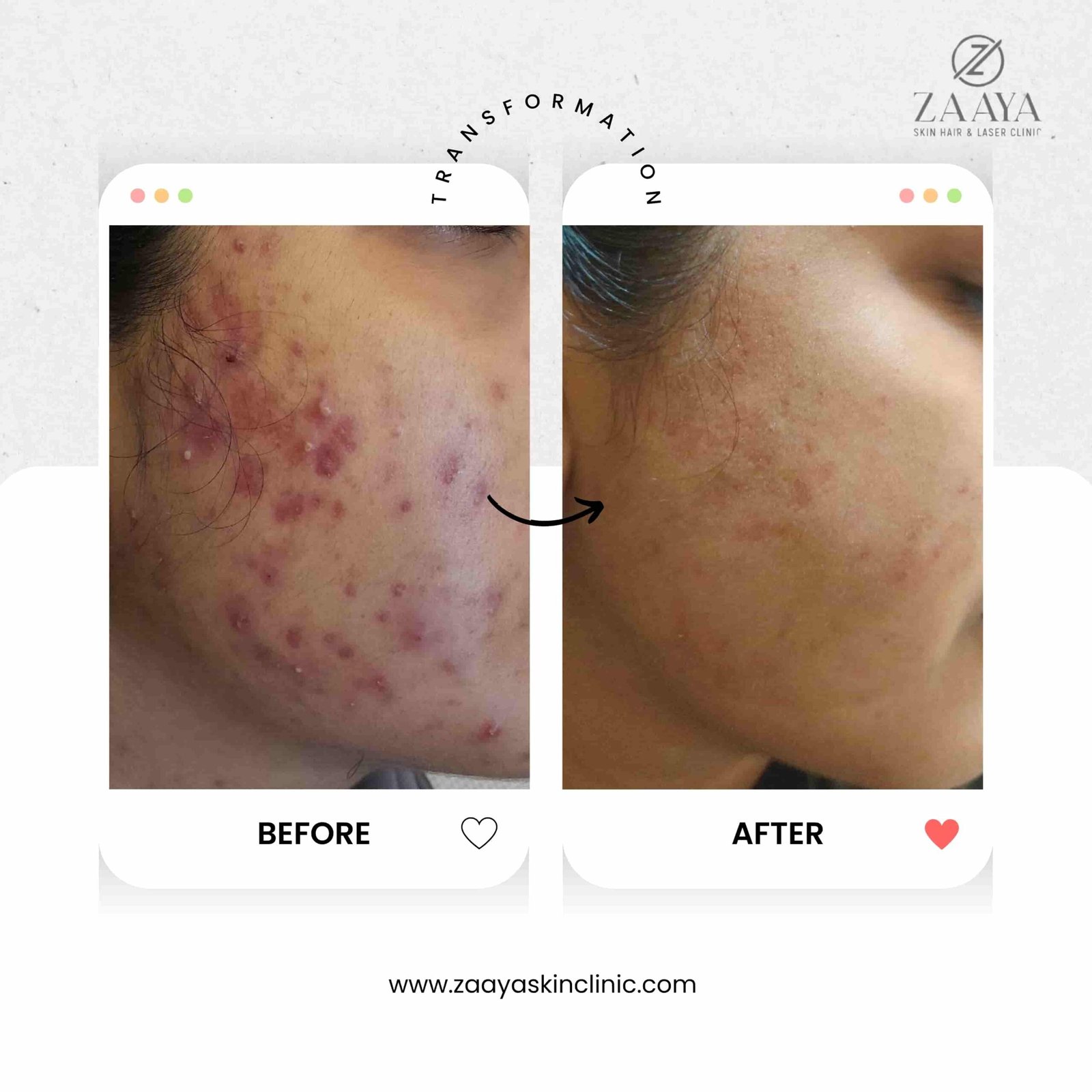 Beige Minimalist Makeup Before and After Instagram Post_20250611_172538_0000-min