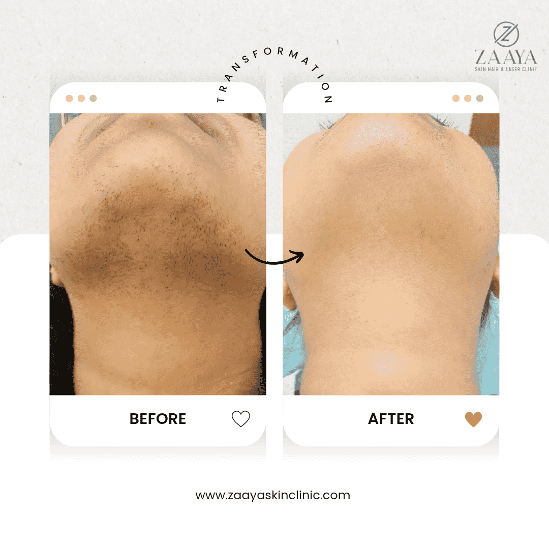 Beige Minimalist Makeup Before and After Instagram Post_20250619_222315_0000-min