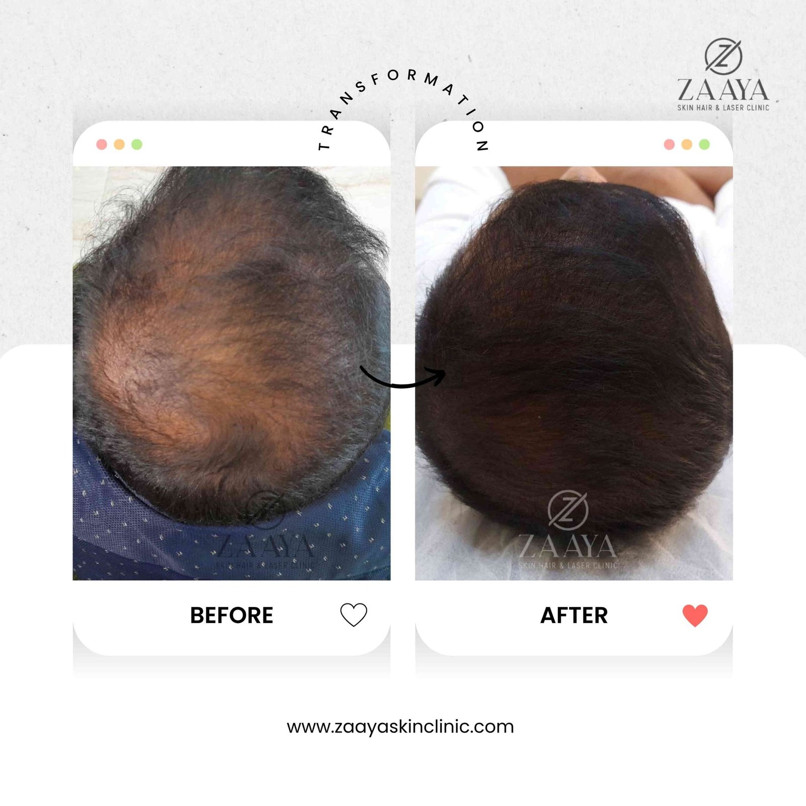 Beige Minimalist Makeup Before and After Instagram Post_20250718_190110_0000