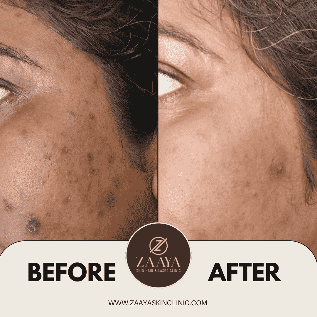 Brown Minimalist Skincare Before After Collage Instagram Post_20250619_210858_0000-min