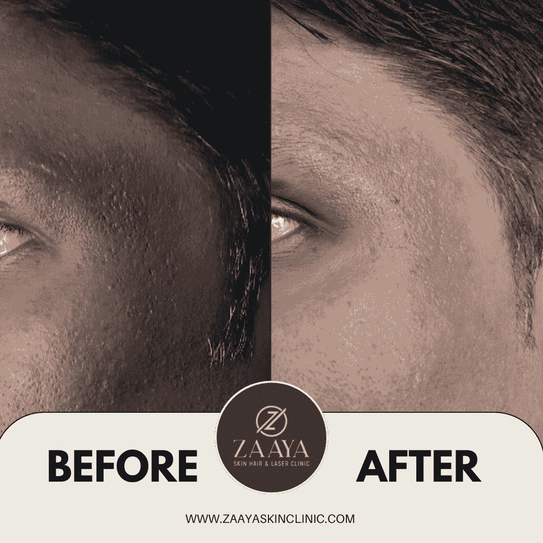 Brown Minimalist Skincare Before After Collage Instagram Post_20250619_211830_0000-min