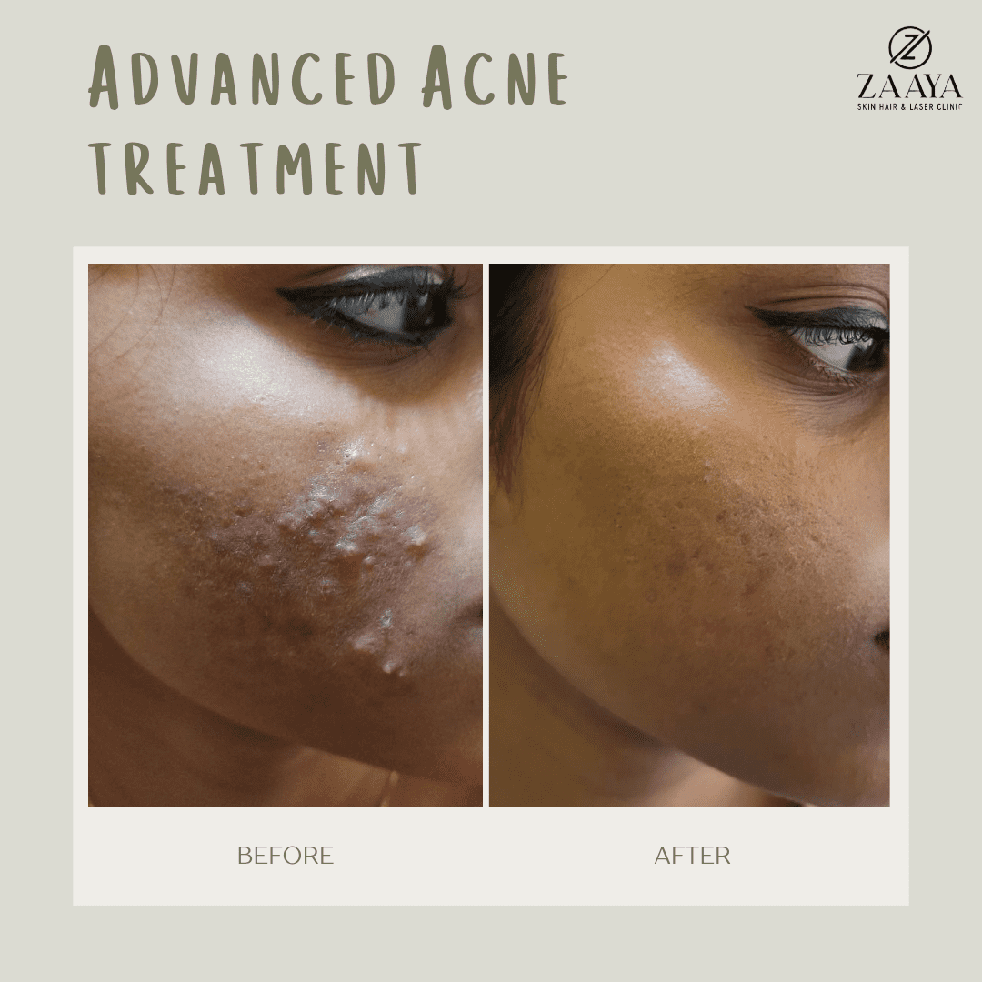 Green Gentle Before and After Instagram Post_20250514_220937_0000-min