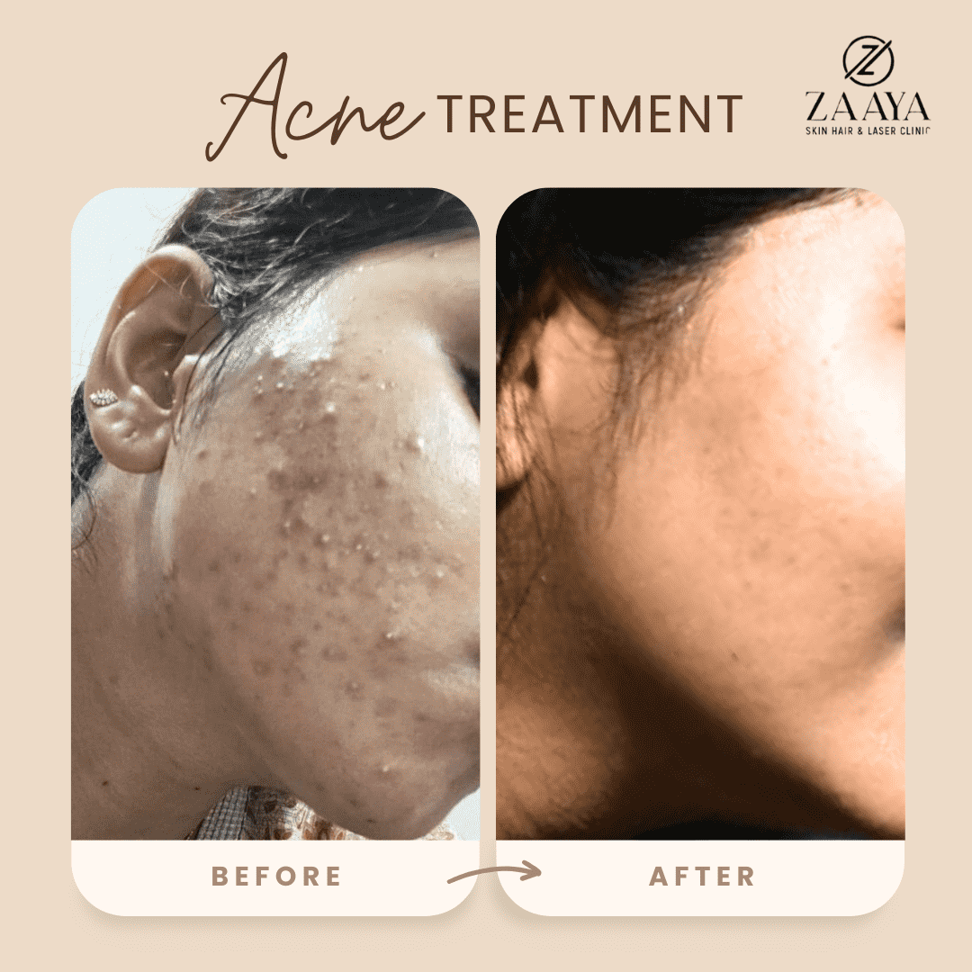 Minimalist Before After Salon & Makeup Instagram Post_20250514_215645_0000-min