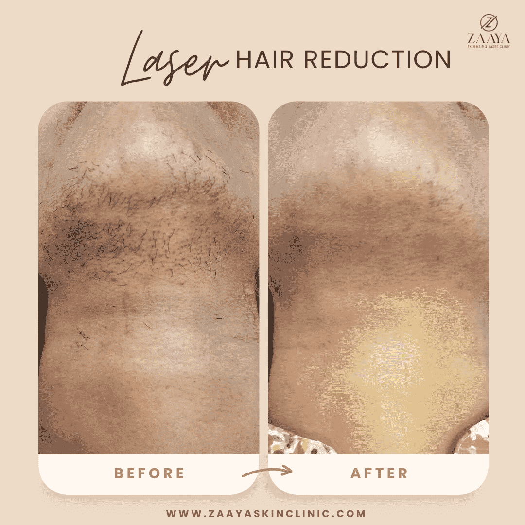 Minimalist Before After Salon & Makeup Instagram Post_20250616_205924_0000-min