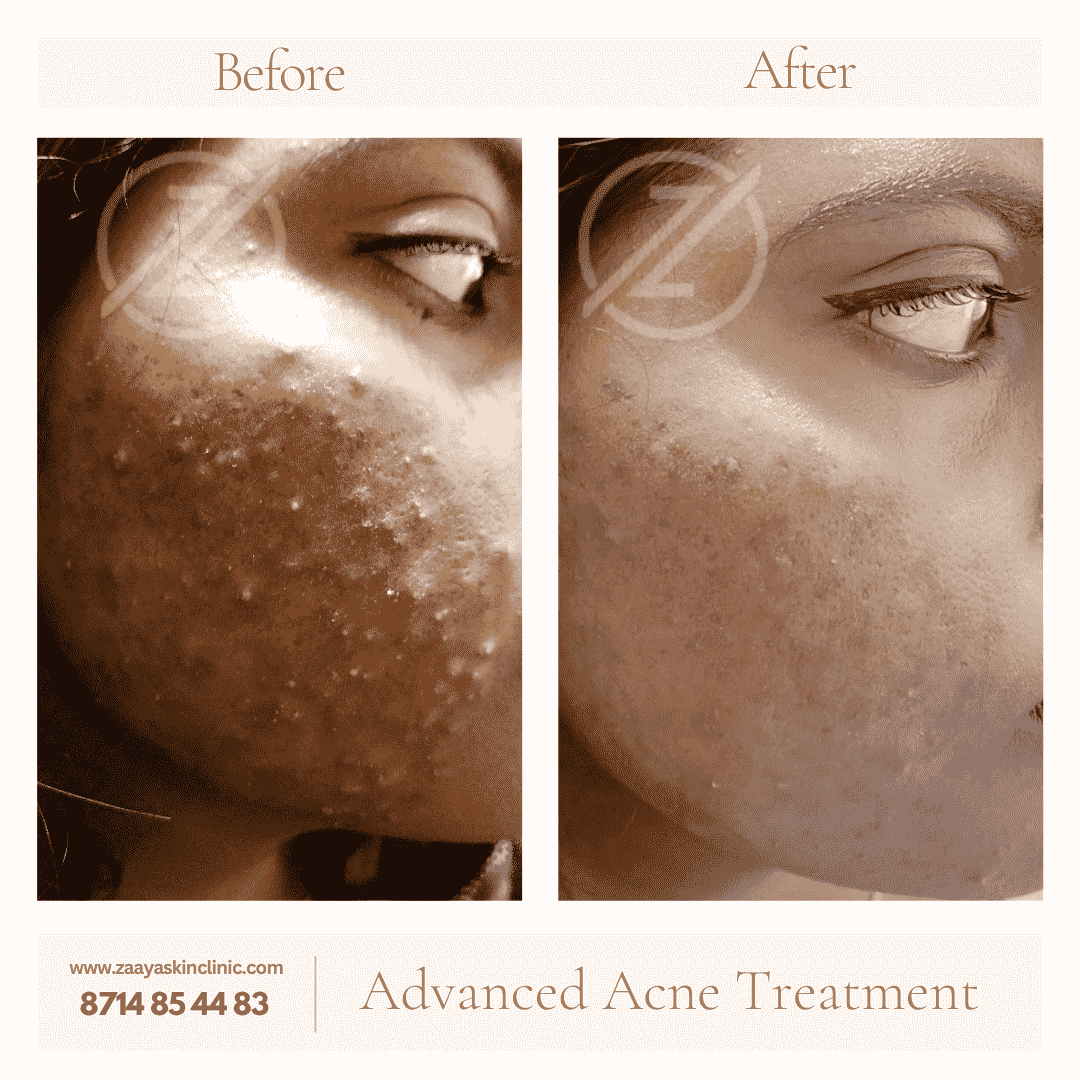 Neutral Before and After Instagram Post_20250514_222529_0000-min