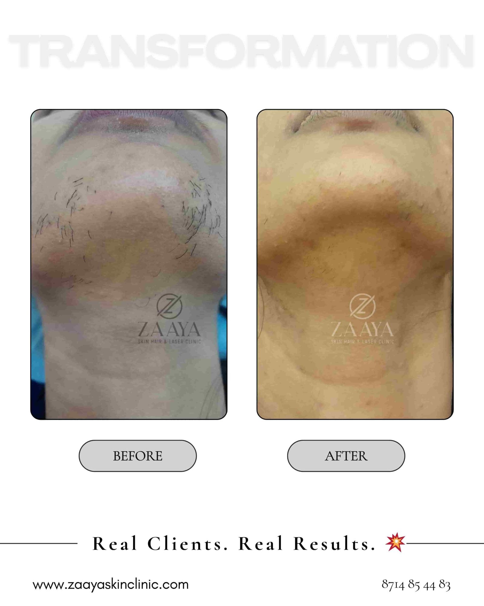 White Neutral Elegant Collage Beauty Photography Before After Instagram Pos_20250713_141413_0000-min